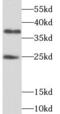 THAP domain-containing protein 1 antibody, FNab08658, FineTest, Western Blot image 