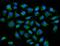 Acyl-CoA Dehydrogenase Medium Chain antibody, A02383-2, Boster Biological Technology, Immunofluorescence image 