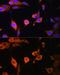 ATP Synthase F1 Subunit Delta antibody, GTX66588, GeneTex, Immunofluorescence image 