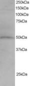 Sorting Nexin 5 antibody, LS-C55503, Lifespan Biosciences, Western Blot image 
