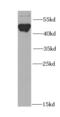 Fli-1 Proto-Oncogene, ETS Transcription Factor antibody, FNab03158, FineTest, Western Blot image 