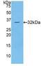 Protein Kinase C Eta antibody, MBS2005397, MyBioSource, Western Blot image 