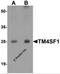 Transmembrane 4 L6 family member 1 antibody, 6229, ProSci, Western Blot image 