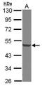 Decapping MRNA 2 antibody, PA5-31091, Invitrogen Antibodies, Western Blot image 