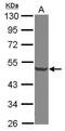 Decapping MRNA 2 antibody, PA5-31091, Invitrogen Antibodies, Western Blot image 