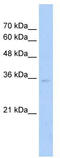 Zinc Finger Protein 547 antibody, TA337773, Origene, Western Blot image 