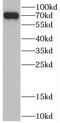 Casein Kinase 1 Alpha 1 Like antibody, FNab02021, FineTest, Western Blot image 