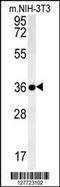 Galectin 9B antibody, 55-027, ProSci, Western Blot image 