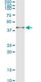 Arginase 2 antibody, MA5-18417, Invitrogen Antibodies, Immunoprecipitation image 