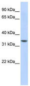 NHL Repeat Containing 3 antibody, TA336106, Origene, Western Blot image 