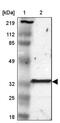 Glutathione S-Transferase Theta 2B (Gene/Pseudogene) antibody, PA5-51451, Invitrogen Antibodies, Western Blot image 