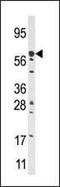 Carnitine Palmitoyltransferase 2 antibody, PA5-12216, Invitrogen Antibodies, Western Blot image 