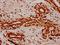 Histone Cluster 1 H2A Family Member M antibody, orb517146, Biorbyt, Immunohistochemistry paraffin image 