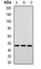 Adaptor Related Protein Complex 1 Subunit Mu 2 antibody, LS-C483000, Lifespan Biosciences, Western Blot image 