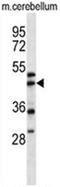Actin Related Protein 1A antibody, AP50073PU-N, Origene, Western Blot image 