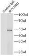 Histone-lysine N-methyltransferase SUV39H1 antibody, FNab08404, FineTest, Immunoprecipitation image 
