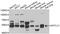 Serine Palmitoyltransferase Long Chain Base Subunit 1 antibody, STJ28833, St John