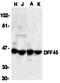 DNA Fragmentation Factor Subunit Alpha antibody, orb74329, Biorbyt, Western Blot image 