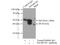 SWI/SNF Related, Matrix Associated, Actin Dependent Regulator Of Chromatin, Subfamily B, Member 1 antibody, 20654-1-AP, Proteintech Group, Immunoprecipitation image 