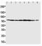 Minichromosome Maintenance Complex Component 7 antibody, PA1792, Boster Biological Technology, Western Blot image 