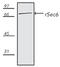 Exocyst Complex Component 3 antibody, GTX12235, GeneTex, Western Blot image 