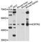 Hypocretin Receptor 2 antibody, STJ23927, St John