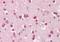 Glutamate Ionotropic Receptor Kainate Type Subunit 1 antibody, orb19566, Biorbyt, Immunohistochemistry paraffin image 