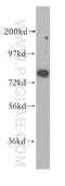 Non-SMC Condensin I Complex Subunit H antibody, 11515-1-AP, Proteintech Group, Western Blot image 