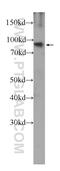 Fibroblast Growth Factor Receptor 1 antibody, 60325-1-Ig, Proteintech Group, Western Blot image 