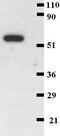 Integrin Subunit Alpha 2b antibody, GTX22211, GeneTex, Western Blot image 