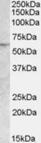 Patatin Like Phospholipase Domain Containing 2 antibody, MBS421617, MyBioSource, Western Blot image 