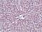 Interleukin 1 Receptor Associated Kinase 1 antibody, MA5-15783, Invitrogen Antibodies, Immunohistochemistry paraffin image 