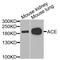 Angiotensin I Converting Enzyme antibody, A7665, ABclonal Technology, Western Blot image 