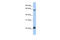 E3 ubiquitin-protein ligase MGRN1 antibody, 25-831, ProSci, Enzyme Linked Immunosorbent Assay image 