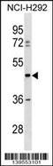 TUB Like Protein 3 antibody, 60-269, ProSci, Western Blot image 