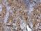 Spleen Associated Tyrosine Kinase antibody, PA5-28574, Invitrogen Antibodies, Immunohistochemistry paraffin image 