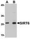 Sirtuin 6 antibody, orb75432, Biorbyt, Western Blot image 