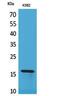 Retinol Binding Protein 2 antibody, PA5-51111, Invitrogen Antibodies, Western Blot image 