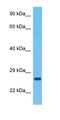 Transmembrane emp24 domain-containing protein 7 antibody, orb327372, Biorbyt, Western Blot image 