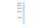 Solute Carrier Family 41 Member 2 antibody, PA5-42499, Invitrogen Antibodies, Western Blot image 