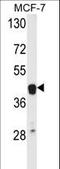 ETS Proto-Oncogene 2, Transcription Factor antibody, LS-B10720, Lifespan Biosciences, Western Blot image 