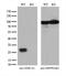 Zinc Ribbon Domain Containing 2 antibody, M33989, Boster Biological Technology, Western Blot image 