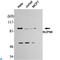 Nucleoporin 98 antibody, LS-C813060, Lifespan Biosciences, Western Blot image 