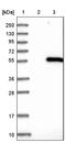 Inositol Hexakisphosphate Kinase 2 antibody, NBP1-89635, Novus Biologicals, Western Blot image 