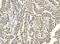Protein Disulfide Isomerase Family A Member 3 antibody, M01464-4, Boster Biological Technology, Immunohistochemistry paraffin image 