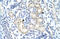 Ribosomal Oxygenase 2 antibody, 29-114, ProSci, Enzyme Linked Immunosorbent Assay image 