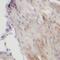 Sarcoglycan Gamma antibody, FNab07803, FineTest, Immunohistochemistry frozen image 