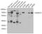 SWI/SNF Related, Matrix Associated, Actin Dependent Regulator Of Chromatin, Subfamily D, Member 1 antibody, A07318, Boster Biological Technology, Western Blot image 