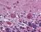 Platelet Derived Growth Factor Receptor Alpha antibody, orb95054, Biorbyt, Immunohistochemistry paraffin image 