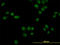 Nuclear Receptor Subfamily 1 Group D Member 1 antibody, LS-B4487, Lifespan Biosciences, Immunofluorescence image 